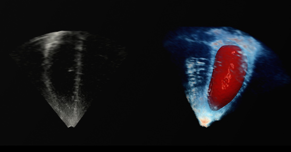 Sample content thumbnail